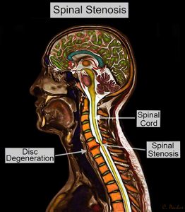 Spinal diagram